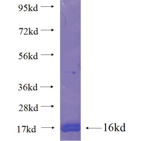 Recombinant human SLC25A36 SDS-PAGE
