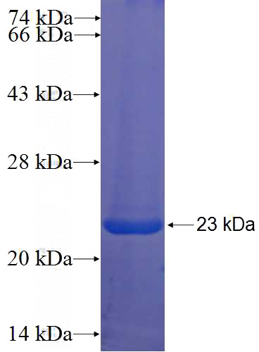 Recombinant Human KCTD9 SDS-PAGE