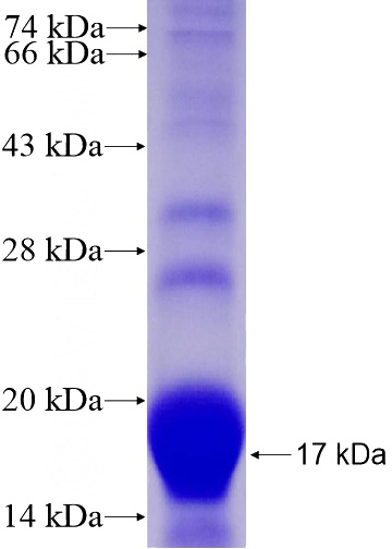 Recombinant Human KIF5A SDS-PAGE