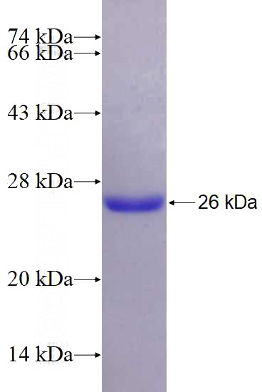 Recombinant Human ARL5B SDS-PAGE