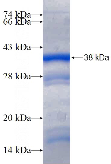 Recombinant Human ARID3A SDS-PAGE