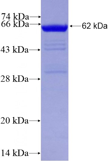 Recombinant Human MYBPC3 SDS-PAGE