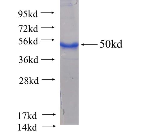 Recombinant human ACADL SDS-PAGE