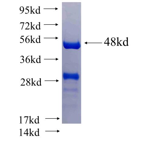 Recombinant human SLC27A3 SDS-PAGE