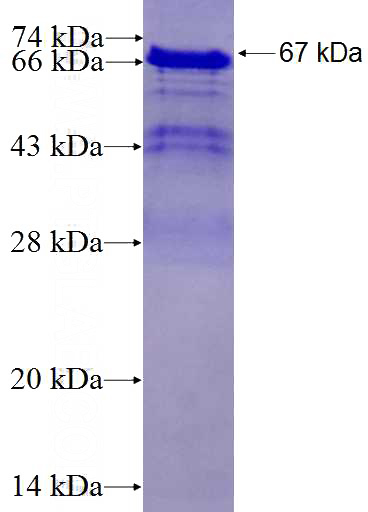 Recombinant Human NACC1 SDS-PAGE