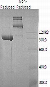 Human AOC1/ABP1/DAO1 (His tag) recombinant protein