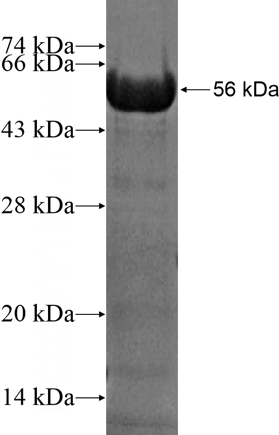 Recombinant Human IFIH1 SDS-PAGE