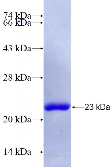 Recombinant Human PTGER4 SDS-PAGE