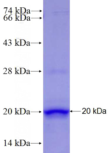 Recombinant Human DUSP15 SDS-PAGE