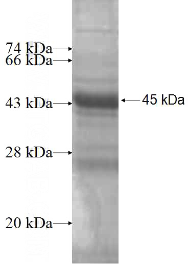 Recombinant Human NDUFB9 SDS-PAGE