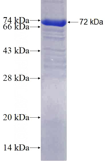 Recombinant Human BCOR SDS-PAGE