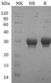 Human EFNB1/EFL3/EPLG2/LERK2 (His tag) recombinant protein