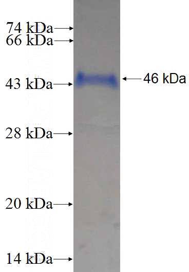Recombinant Human ARL3 SDS-PAGE