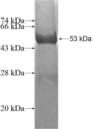 Recombinant Human HSCB SDS-PAGE