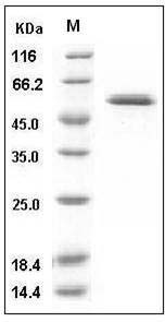 Human Glucokinase / GCK Protein SDS-PAGE