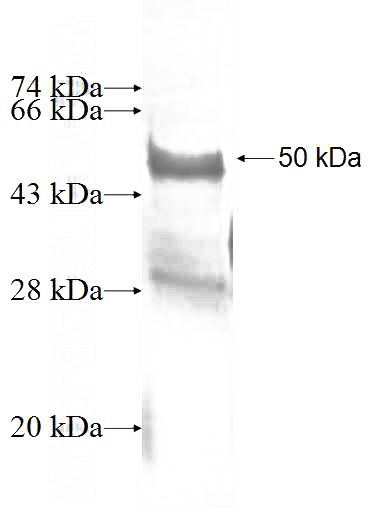 Recombinant Human HECTD3 SDS-PAGE
