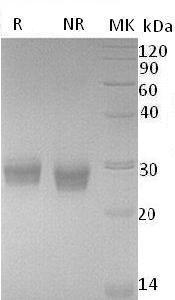 Human TNFRSF11A/RANK (His tag) recombinant protein
