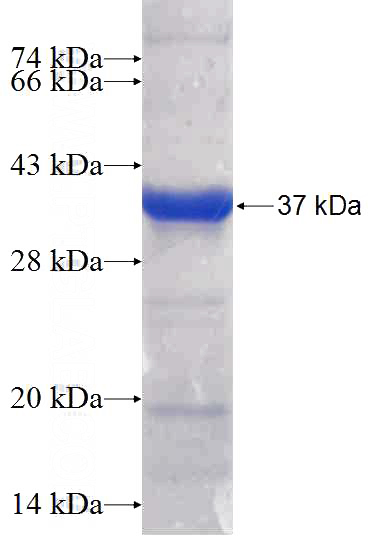 Recombinant Human CAPN9 SDS-PAGE