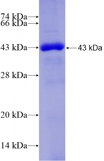 Recombinant Human CSE1L SDS-PAGE