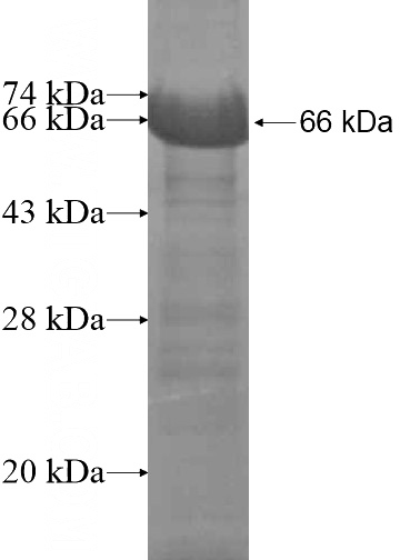 Recombinant Human CXorf41 SDS-PAGE
