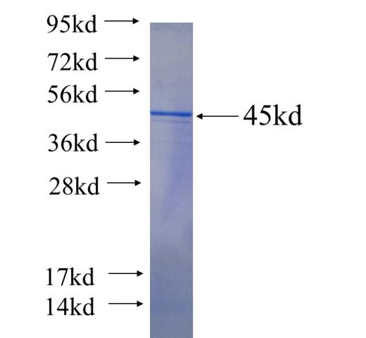 Recombinant human SAMD9 SDS-PAGE