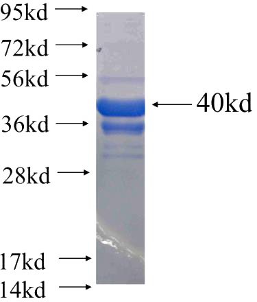 Recombinant Human NFATC4 SDS-PAGE