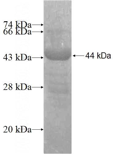 Recombinant Human AP2B1 SDS-PAGE