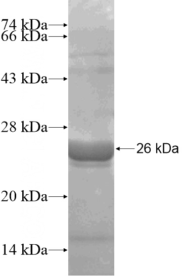 Recombinant Human CHSY3 SDS-PAGE