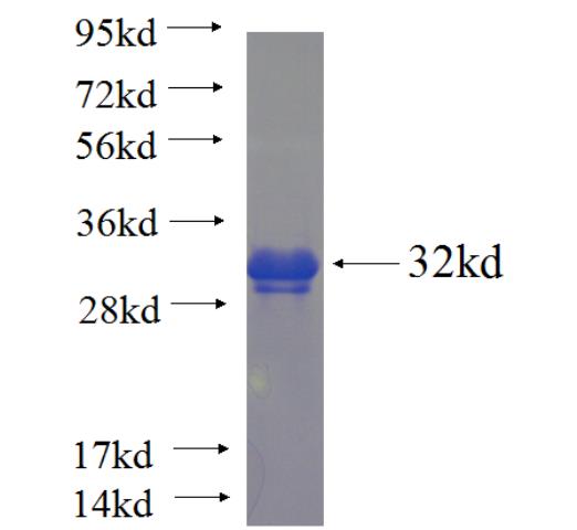 Recombinant human tubulin-beta SDS-PAGE