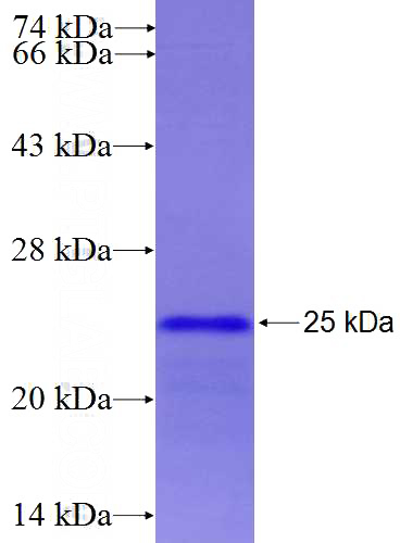 Recombinant Human CNBP SDS-PAGE