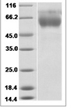 Influenza A H3N2 (A/Guizhou/54/1989) Hemagglutinin / HA1 Protein (His Tag)