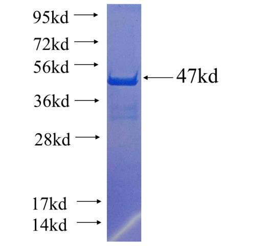 Recombinant human ITGB1BP1 SDS-PAGE