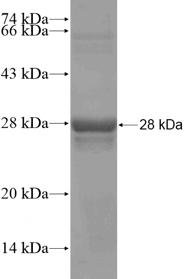 Recombinant Human KLF16 SDS-PAGE
