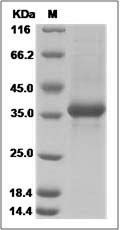 Human NPY / Neuropeptide Y Protein (Fc Tag) SDS-PAGE