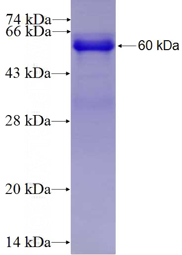 Recombinant Human KLHL6 SDS-PAGE