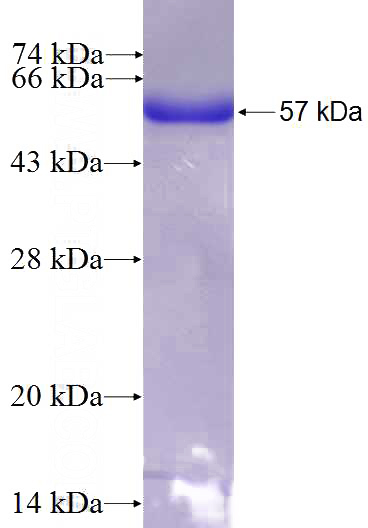 Recombinant Human KLHL3 SDS-PAGE