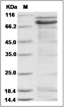 Rat E-Cadherin / CDH1 / E-cad / CD324 Protein (His Tag) SDS-PAGE