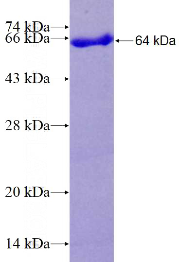 Recombinant Human RASGRP3 SDS-PAGE