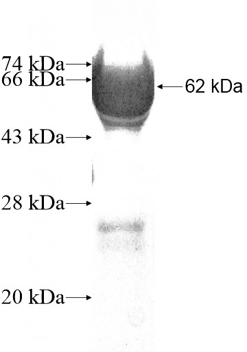 Recombinant Human Peripherin SDS-PAGE
