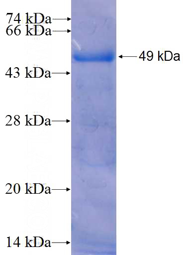 Recombinant Human NR2F2 SDS-PAGE
