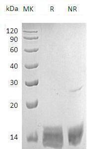 Human S100A8/S100A9 Heterodimer (His tag) recombinant protein