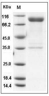 Rat IL1R1 / CD121a Protein (His & Fc Tag) SDS-PAGE