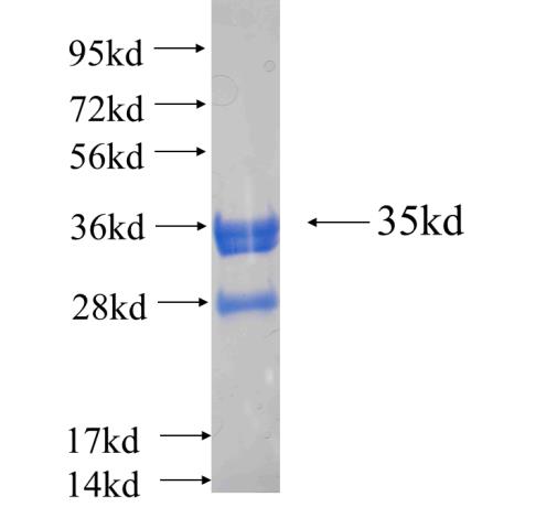 Recombinant human TSC22D3 SDS-PAGE