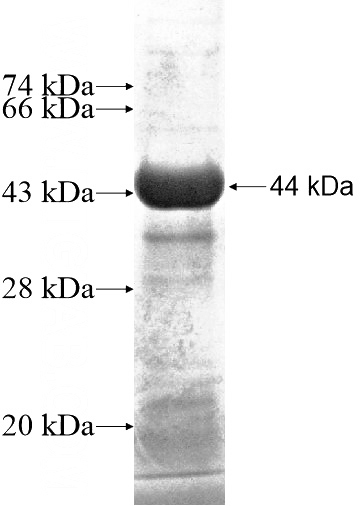 Recombinant Human RAI14 SDS-PAGE