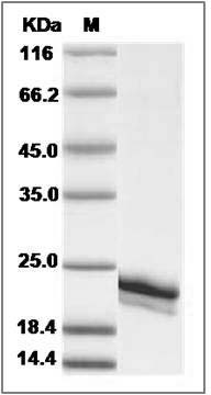 Cynomolgus IFNA2 / Interferon alpha 2 Protein (His Tag) SDS-PAGE