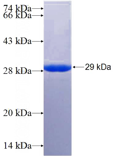 Recombinant Human LBR SDS-PAGE