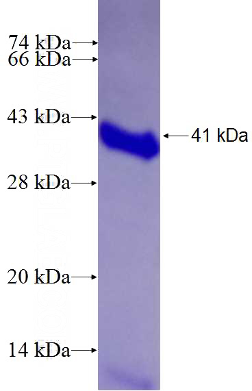 Recombinant Human NRIP1 SDS-PAGE