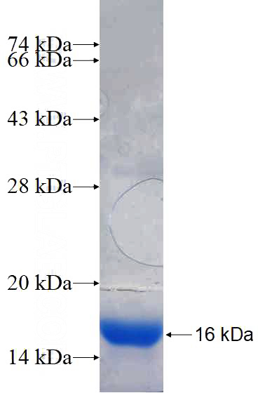 Recombinant Human ITK SDS-PAGE