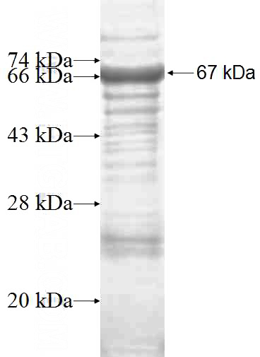 Recombinant Human JIP1 SDS-PAGE