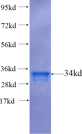 Recombinant Human CDGAP SDS-PAGE